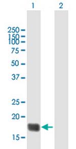TMEM86B Polyclonal Antibody, MaxPab™