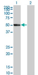 RASGEF1C Monoclonal Antibody (3H8)