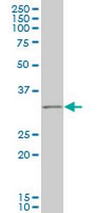 IBRDC2 Antibody in Western Blot (WB)