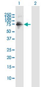 ZNF549 Antibody in Western Blot (WB)