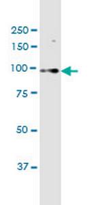 C15orf55 Monoclonal Antibody (8B1)