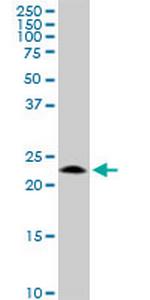 GCET2 Monoclonal Antibody (1E9)