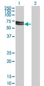 SH3PX3 Monoclonal Antibody (3A1)