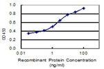ANKS4B Antibody in ELISA (ELISA)