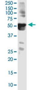 ANKS4B Monoclonal Antibody (3E3)
