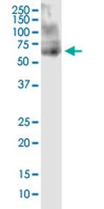 ANKS4B Antibody in Western Blot (WB)