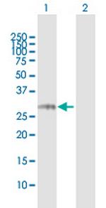 NCR3 Polyclonal Antibody, MaxPab™
