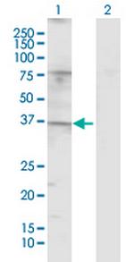 TAS2R49 Polyclonal Antibody, MaxPab™