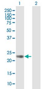 GPR110 Polyclonal Antibody, MaxPab™