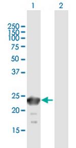 SSX6 Polyclonal Antibody, MaxPab™