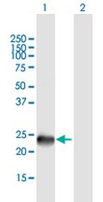SSX9 Polyclonal Antibody, MaxPab™
