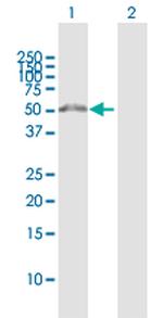WDR51B Antibody in Western Blot (WB)