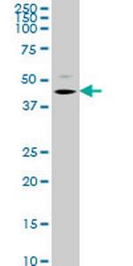 STK32C Monoclonal Antibody (4G2)