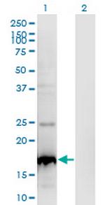 BLOC1S2 Monoclonal Antibody (8C10)
