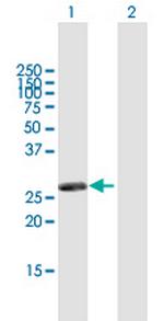 RASSF3 Polyclonal Antibody, MaxPab™