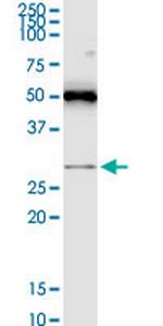 RASSF3 Monoclonal Antibody (3A5)