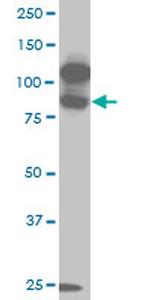 KSR2 Antibody in Western Blot (WB)