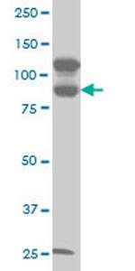 KSR2 Monoclonal Antibody (5E9)