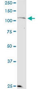KSR2 Monoclonal Antibody (1G4)