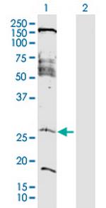 FAM177A1 Polyclonal Antibody, MaxPab™