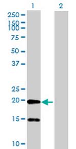 FLJ39743 Polyclonal Antibody, MaxPab™