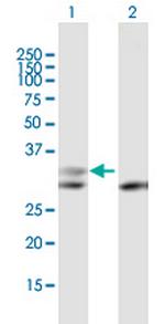 PGP Polyclonal Antibody, MaxPab™