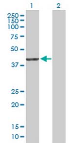 PDXDC2 Antibody in Western Blot (WB)