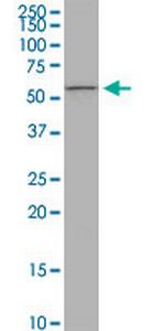 PIGW Monoclonal Antibody (1D8)