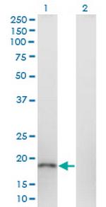 FAM44C Monoclonal Antibody (1C9)