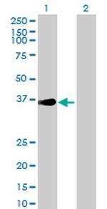 ZIK1 Polyclonal Antibody, MaxPab™