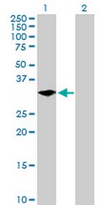 LYPD5 Antibody in Western Blot (WB)