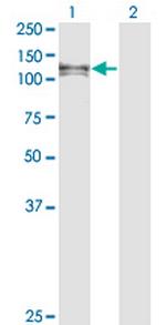 EPHA6 Monoclonal Antibody (2H2)
