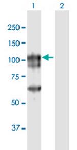 CAGE1 Antibody in Western Blot (WB)