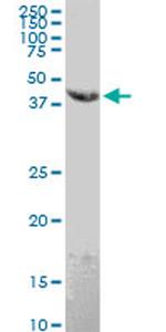 EMR4P Antibody in Western Blot (WB)