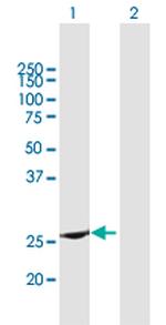 RAB37 Polyclonal Antibody, MaxPab™