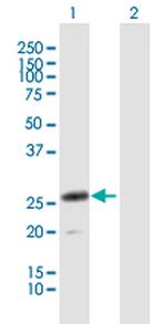 CLEC4D Polyclonal Antibody, MaxPab™