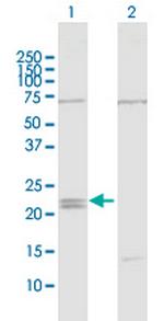 IFNE Polyclonal Antibody, MaxPab™