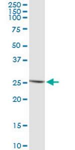 IFNE1 Monoclonal Antibody (3B8)
