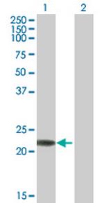 RAB7B Polyclonal Antibody, MaxPab™