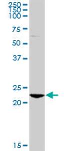 RAB7B Antibody in Western Blot (WB)