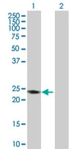 RAB7B Polyclonal Antibody, MaxPab™