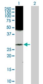 RAB43 Polyclonal Antibody, MaxPab™