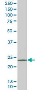 RAB43 Monoclonal Antibody (5G4)