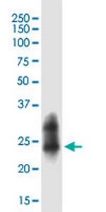 RAB43 Monoclonal Antibody (5G4)