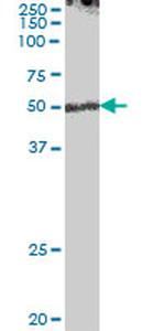 ENPP7 Antibody in Western Blot (WB)