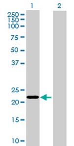 KLHL17 Polyclonal Antibody, MaxPab™