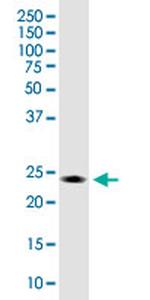 ZBTB8OS Antibody in Western Blot (WB)