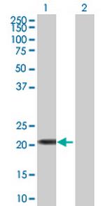 FLJ36180 Antibody in Western Blot (WB)