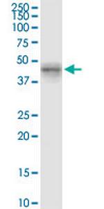 MYLK4 Monoclonal Antibody (7A3)