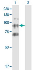 CTAGE6 Polyclonal Antibody, MaxPab™